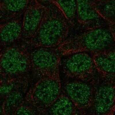 Immunocytochemistry/ Immunofluorescence: ZBTB1 Antibody [NBP3-17457]