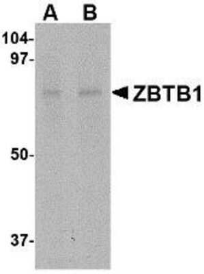 Western Blot: ZBTB1 AntibodyBSA Free [NBP1-76970]