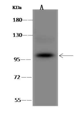 Western Blot: ZBTB1 Antibody [NBP3-06288]