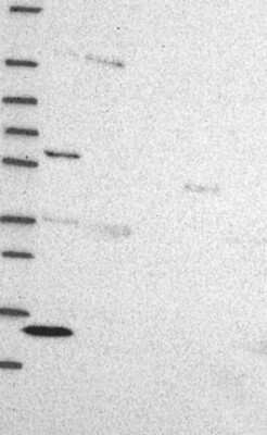 Western Blot: ZBTB1 Antibody [NBP3-17457]