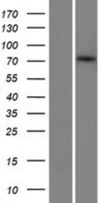 Western Blot: ZBTB1 Overexpression Lysate [NBP2-07243]