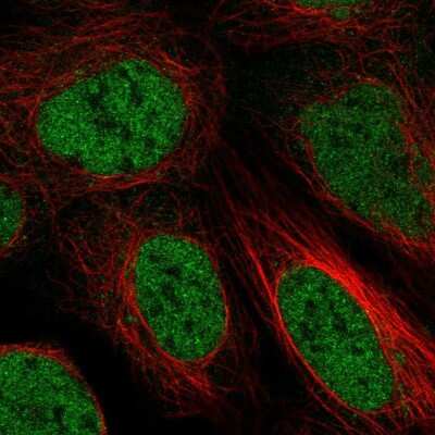 Immunocytochemistry/ Immunofluorescence: ZBTB10 Antibody [NBP2-55350]