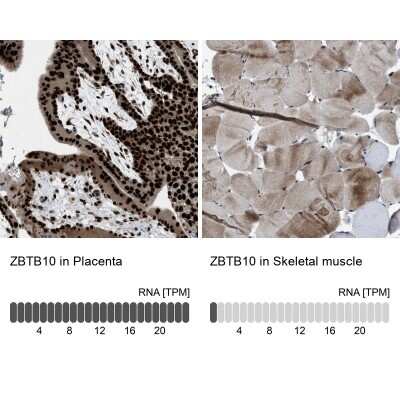 Immunohistochemistry-Paraffin: ZBTB10 Antibody [NBP1-83714]