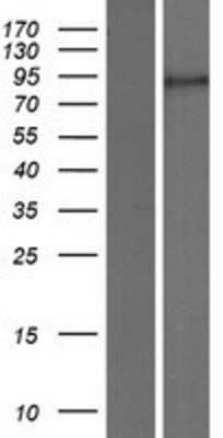 Western Blot: ZBTB10 Overexpression Lysate [NBP2-09359]