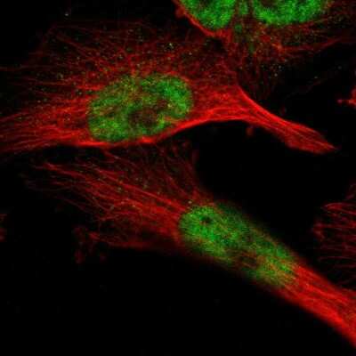 Immunocytochemistry/ Immunofluorescence: ZBTB11 Antibody [NBP1-80581]
