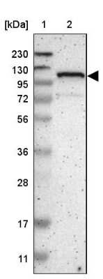 Western Blot: ZBTB11 Antibody [NBP1-80581]