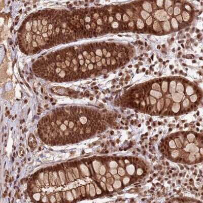 Immunohistochemistry-Paraffin: ZBTB12 Antibody [NBP2-33480]