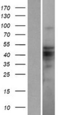 Western Blot: ZBTB12 Overexpression Lysate [NBP2-04867]