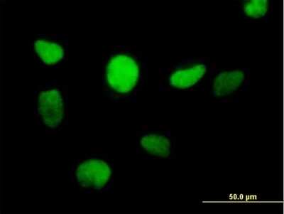 Immunocytochemistry/ Immunofluorescence: ZBTB14 Antibody [H00007541-B01P]