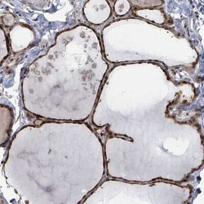 Immunohistochemistry: ZBTB14 Antibody [NBP2-47576]