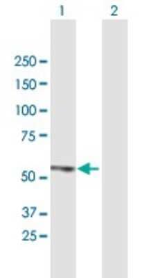 Western Blot: ZBTB14 Antibody [H00007541-B01P]