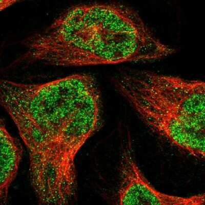 Immunocytochemistry/ Immunofluorescence: ZBTB2 Antibody [NBP1-88787]