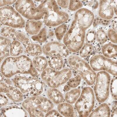 Immunohistochemistry-Paraffin: ZBTB2 Antibody [NBP1-88786]