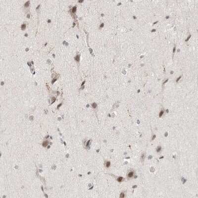 Immunohistochemistry-Paraffin: ZBTB2 Antibody [NBP1-88787]