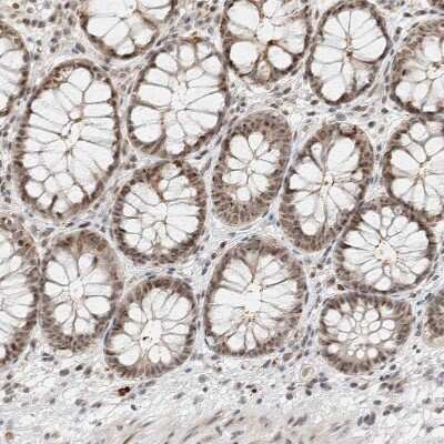 Immunohistochemistry-Paraffin: ZBTB2 Antibody [NBP1-88787]