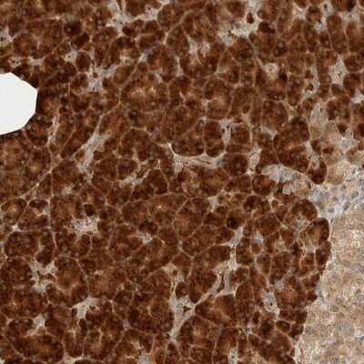 Immunohistochemistry-Paraffin: ZBTB2 Antibody [NBP1-88788]