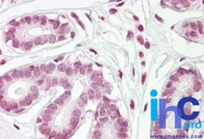 Immunohistochemistry-Paraffin: ZBTB2 Antibody [NBP2-24660]