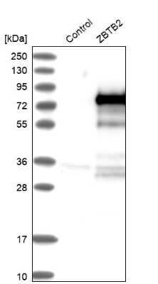 Western Blot: ZBTB2 Antibody [NBP1-88786]