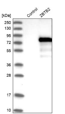 Western Blot: ZBTB2 Antibody [NBP1-88788]