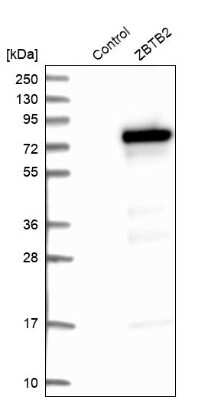 Western Blot: ZBTB2 Antibody [NBP1-88789]