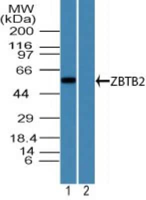 Western Blot: ZBTB2 Antibody [NBP2-24660]