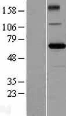 Western Blot: ZBTB2 Overexpression Lysate [NBL1-17964]