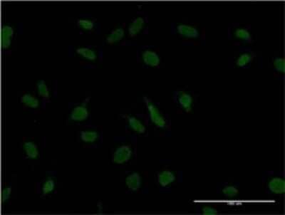 Immunocytochemistry/ Immunofluorescence: ZBTB20 Antibody (1F3) [H00026137-M01]