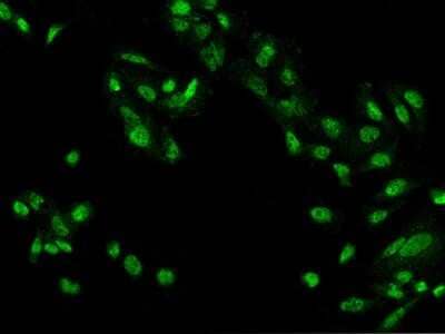 Immunocytochemistry/ Immunofluorescence: ZBTB20 Antibody [NBP2-98114]