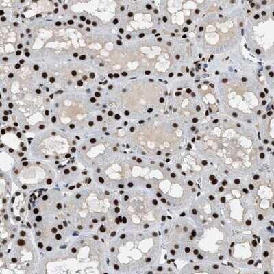 Immunohistochemistry-Paraffin: ZBTB20 Antibody [NBP1-84146]