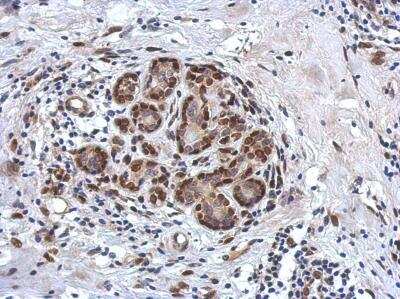 Immunohistochemistry-Paraffin: ZBTB20 Antibody [NBP2-20936]