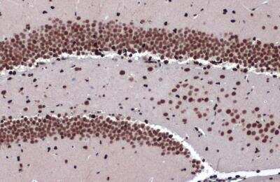 Immunohistochemistry-Paraffin: ZBTB20 Antibody [NBP2-20936]