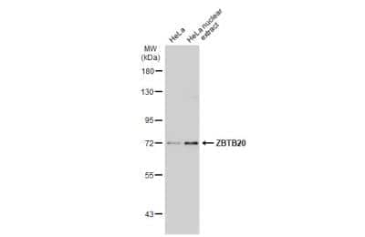 Western Blot: ZBTB20 Antibody [NBP2-20936]