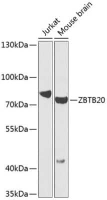 Western Blot: ZBTB20 AntibodyBSA Free [NBP2-93684]