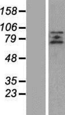 Western Blot: ZBTB20 Overexpression Lysate [NBP2-07138]