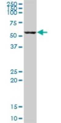 Western Blot: ZBTB22 Antibody [H00009278-B01P]