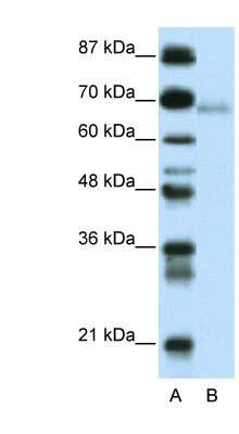 Western Blot: ZBTB22 Antibody [NBP1-80113]