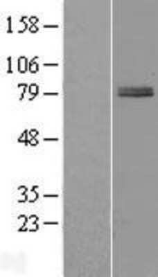 Western Blot: ZBTB22 Overexpression Lysate [NBP2-09740]