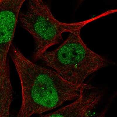 Immunocytochemistry/ Immunofluorescence: ZBTB24 Antibody [NBP2-33856]