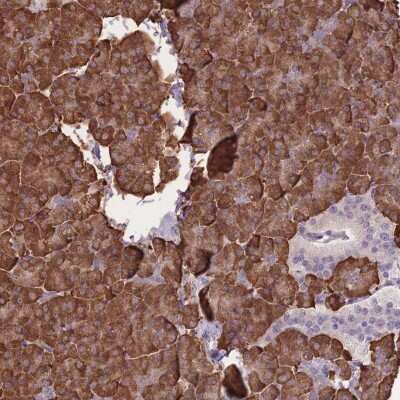 Immunohistochemistry-Paraffin: ZBTB24 Antibody [NBP2-33545]