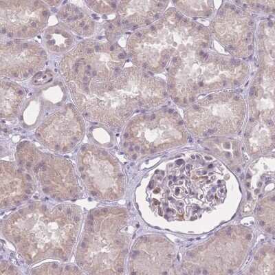 Immunohistochemistry-Paraffin: ZBTB24 Antibody [NBP2-33545]