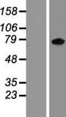 Western Blot: ZBTB24 Overexpression Lysate [NBP2-07270]