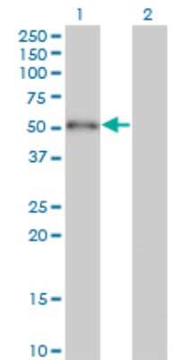 Western Blot: ZBTB25 Antibody (2B8) [H00007597-M05]