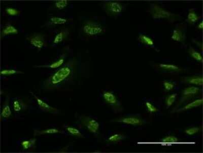 Immunocytochemistry/ Immunofluorescence: ZBTB25 Antibody (2E8) [H00007597-M02]