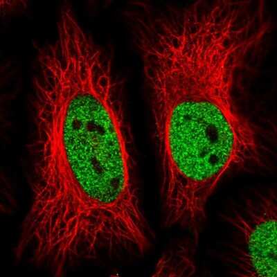 Immunocytochemistry/ Immunofluorescence: ZBTB25 Antibody [NBP2-31583]