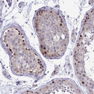 Immunohistochemistry: ZBTB25 Antibody [NBP2-31583]