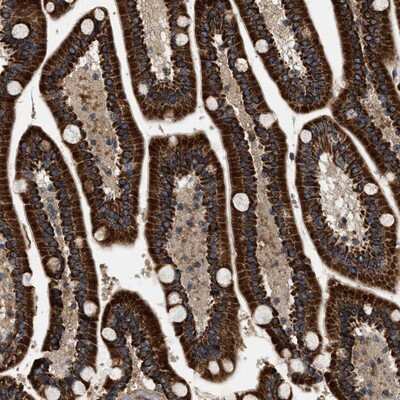 Immunohistochemistry-Paraffin: ZBTB26 Antibody [NBP1-80591]