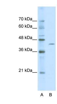 Western Blot: ZBTB26 Antibody [NBP1-80120]