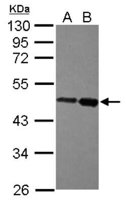 Western Blot: ZBTB26 Antibody [NBP2-20937]