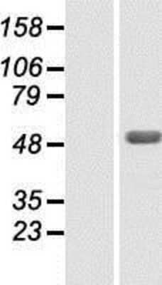 Western Blot: ZBTB26 Overexpression Lysate [NBP2-06592]