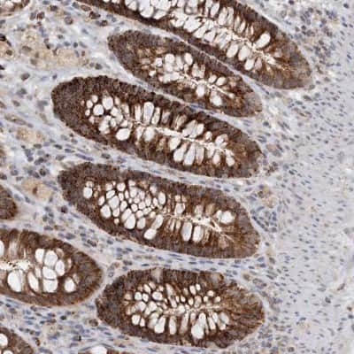 Immunohistochemistry: ZBTB3 Antibody [NBP2-48636]